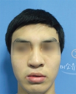MISOU Plastic Surgery, Reviews,Images, Promotions — Korea cost, reviews & before-after | MISOODA
