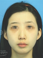 MISOU Plastic Surgery, Reviews,Images, Promotions — Korea cost, reviews & before-after | MISOODA