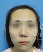 MISOU Plastic Surgery, Reviews,Images, Promotions — Korea cost, reviews & before-after | MISOODA