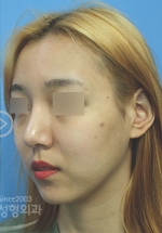 MISOU Plastic Surgery, Reviews,Images, Promotions — Korea cost, reviews & before-after | MISOODA