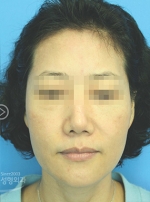 MISOU Plastic Surgery, Reviews,Images, Promotions — Korea cost, reviews & before-after | MISOODA