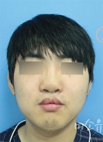 MISOU Plastic Surgery, Reviews,Images, Promotions — Korea cost, reviews & before-after | MISOODA