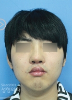 MISOU Plastic Surgery, Reviews,Images, Promotions — Korea cost, reviews & before-after | MISOODA
