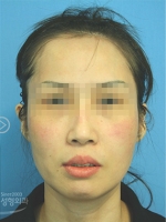MISOU Plastic Surgery, Reviews,Images, Promotions — Korea cost, reviews & before-after | MISOODA