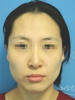 MISOU Plastic Surgery, Reviews,Images, Promotions — Korea cost, reviews & before-after | MISOODA