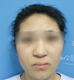 MISOU Plastic Surgery, Reviews,Images, Promotions — Korea cost, reviews & before-after | MISOODA