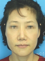 MISOU Plastic Surgery, Reviews,Images, Promotions — Korea cost, reviews & before-after | MISOODA