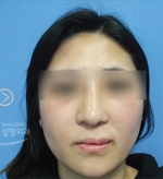 MISOU Plastic Surgery, Reviews,Images, Promotions — Korea cost, reviews & before-after | MISOODA