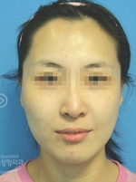 MISOU Plastic Surgery, Reviews,Images, Promotions — Korea cost, reviews & before-after | MISOODA