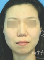 MISOU Plastic Surgery, Reviews,Images, Promotions — Korea cost, reviews & before-after | MISOODA