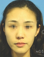 MISOU Plastic Surgery, Reviews,Images, Promotions — Korea cost, reviews & before-after | MISOODA