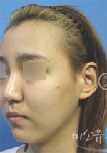 MISOU Plastic Surgery, Reviews,Images, Promotions — Korea cost, reviews & before-after | MISOODA