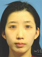 MISOU Plastic Surgery, Reviews,Images, Promotions — Korea cost, reviews & before-after | MISOODA