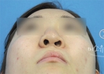 MISOU Plastic Surgery, Reviews,Images, Promotions — Korea cost, reviews & before-after | MISOODA