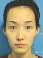 MISOU Plastic Surgery, Reviews,Images, Promotions — Korea cost, reviews & before-after | MISOODA