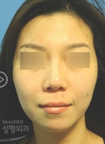 MISOU Plastic Surgery, Reviews,Images, Promotions — Korea cost, reviews & before-after | MISOODA