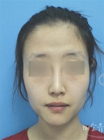 MISOU Plastic Surgery, Reviews,Images, Promotions — Korea cost, reviews & before-after | MISOODA