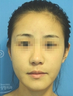 MISOU Plastic Surgery, Reviews,Images, Promotions — Korea cost, reviews & before-after | MISOODA