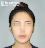 Beauty Line Plastic Surgery,Reviews,Images, Promotions — Korea cost, reviews & before-after | MISOODA