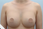 Glovi Plastic Surgery, Reviews, Images, Promotions, Dr. Rho Bongil, Dr. Nam Sangjae, Dr. Park Jongchul — Korea cost, reviews & before-after | MISOODA