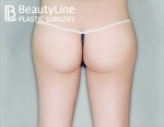 Beauty Line Plastic Surgery,Reviews,Images, Promotions — Korea cost, reviews & before-after | MISOODA