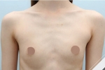 Glovi Plastic Surgery, Reviews, Images, Promotions, Dr. Rho Bongil, Dr. Nam Sangjae, Dr. Park Jongchul — Korea cost, reviews & before-after | MISOODA