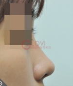 Glovi Plastic Surgery, Reviews, Images, Promotions, Dr. Rho Bongil, Dr. Nam Sangjae, Dr. Park Jongchul — Korea cost, reviews & before-after | MISOODA