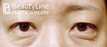 Beauty Line Plastic Surgery,Reviews,Images, Promotions — Korea cost, reviews & before-after | MISOODA