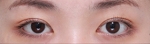 GYALUMHAN Plastic Surgery,Reviews,Images, Promotions — Korea cost, reviews & before-after | MISOODA