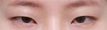 GYALUMHAN Plastic Surgery,Reviews,Images, Promotions — Korea cost, reviews & before-after | MISOODA