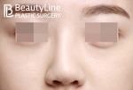 Beauty Line Plastic Surgery,Reviews,Images, Promotions — Korea cost, reviews & before-after | MISOODA