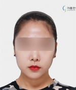 GYALUMHAN Plastic Surgery,Reviews,Images, Promotions — Korea cost, reviews & before-after | MISOODA