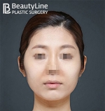 Beauty Line Plastic Surgery,Reviews,Images, Promotions — Korea cost, reviews & before-after | MISOODA