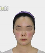 GYALUMHAN Plastic Surgery,Reviews,Images, Promotions — Korea cost, reviews & before-after | MISOODA