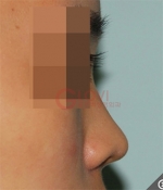 Glovi Plastic Surgery, Reviews, Images, Promotions, Dr. Rho Bongil, Dr. Nam Sangjae, Dr. Park Jongchul — Korea cost, reviews & before-after | MISOODA