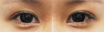 Glovi Plastic Surgery, Reviews, Images, Promotions, Dr. Rho Bongil, Dr. Nam Sangjae, Dr. Park Jongchul — Korea cost, reviews & before-after | MISOODA