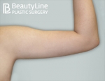 Beauty Line Plastic Surgery,Reviews,Images, Promotions — Korea cost, reviews & before-after | MISOODA