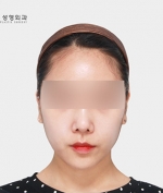 GYALUMHAN Plastic Surgery,Reviews,Images, Promotions — Korea cost, reviews & before-after | MISOODA