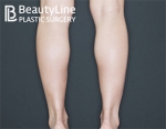 Beauty Line Plastic Surgery,Reviews,Images, Promotions — Korea cost, reviews & before-after | MISOODA