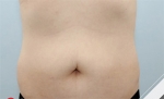 Glovi Plastic Surgery, Reviews, Images, Promotions, Dr. Rho Bongil, Dr. Nam Sangjae, Dr. Park Jongchul — Korea cost, reviews & before-after | MISOODA