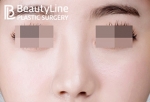 Beauty Line Plastic Surgery,Reviews,Images, Promotions — Korea cost, reviews & before-after | MISOODA