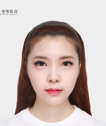 GYALUMHAN Plastic Surgery,Reviews,Images, Promotions — Korea cost, reviews & before-after | MISOODA