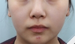 Glovi Plastic Surgery, Reviews, Images, Promotions, Dr. Rho Bongil, Dr. Nam Sangjae, Dr. Park Jongchul — Korea cost, reviews & before-after | MISOODA