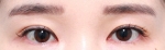 GYALUMHAN Plastic Surgery,Reviews,Images, Promotions — Korea cost, reviews & before-after | MISOODA