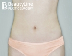 Beauty Line Plastic Surgery,Reviews,Images, Promotions — Korea cost, reviews & before-after | MISOODA