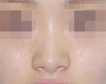 GYALUMHAN Plastic Surgery,Reviews,Images, Promotions — Korea cost, reviews & before-after | MISOODA