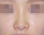 GYALUMHAN Plastic Surgery,Reviews,Images, Promotions — Korea cost, reviews & before-after | MISOODA