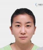 GYALUMHAN Plastic Surgery,Reviews,Images, Promotions — Korea cost, reviews & before-after | MISOODA