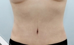 Glovi Plastic Surgery, Reviews, Images, Promotions, Dr. Rho Bongil, Dr. Nam Sangjae, Dr. Park Jongchul — Korea cost, reviews & before-after | MISOODA