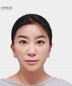 GYALUMHAN Plastic Surgery,Reviews,Images, Promotions — Korea cost, reviews & before-after | MISOODA